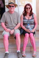 Sunburn or Holi aftermath?